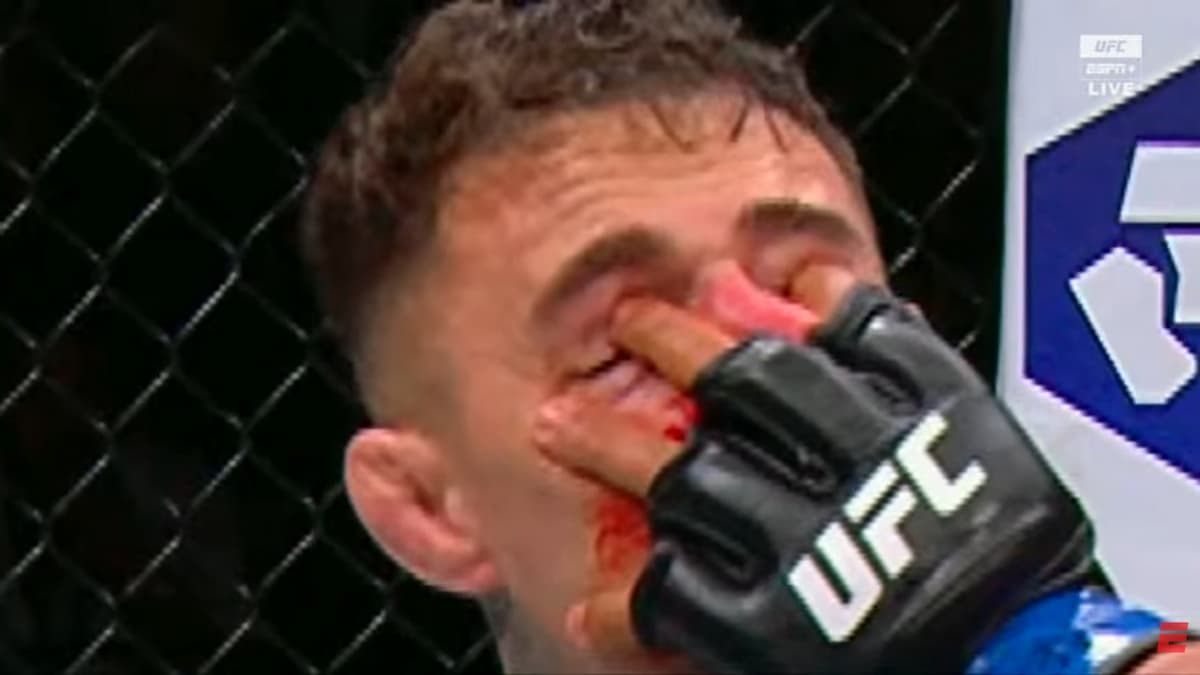 Preview Йиржи Прохазка резко высказался об инциденте с тычком в глаз Тома Аспиналла на UFC 321