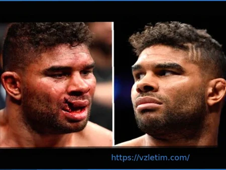 Звезда UFC показала шокирующее видео: из ее глаза извлекли трубку после ужасной травмы