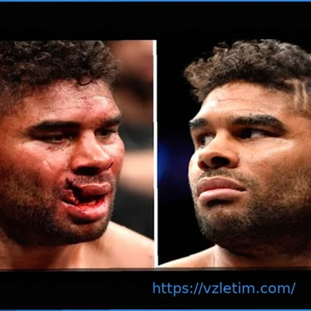 Звезда UFC показала шокирующее видео: из ее глаза извлекли трубку после ужасной травмы